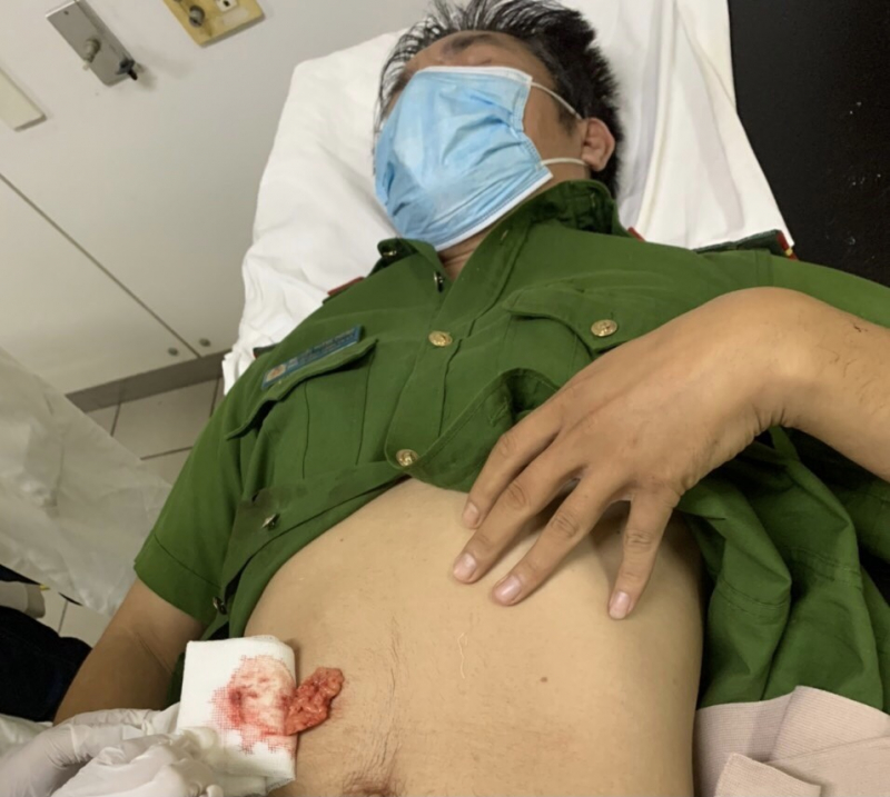 Phê chuẩn quyết định khởi tố đối tượng đâm thủng ruột Phó Trưởng Công an xã -0