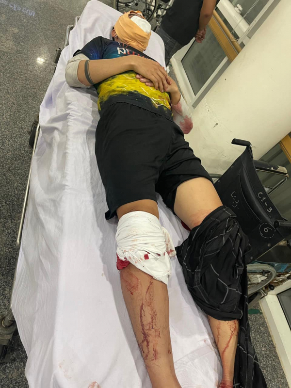 Xích mích trên sân bóng, kéo hơn 10 đối tượng đến chém người -0