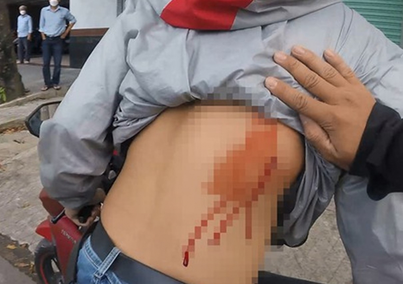 Tấn công người đi đường để cướp xe bỏ chạy khi bị truy đuổi -1