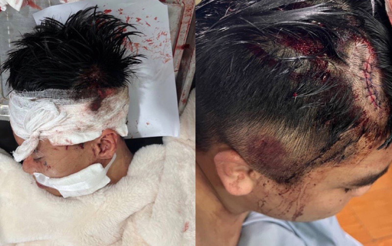 chemtrongthuong_o.jpg -0