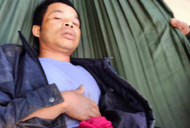 Nam thanh niên bị trâu húc thủng bụng -0