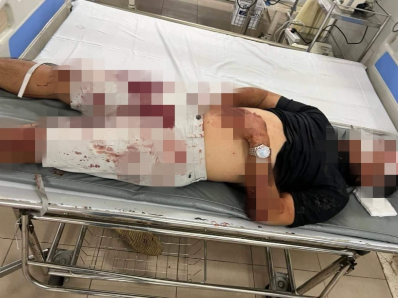 Bị đánh hội đồng sau khi mâu thuẫn với nữ nhân viên quán karaoke -0