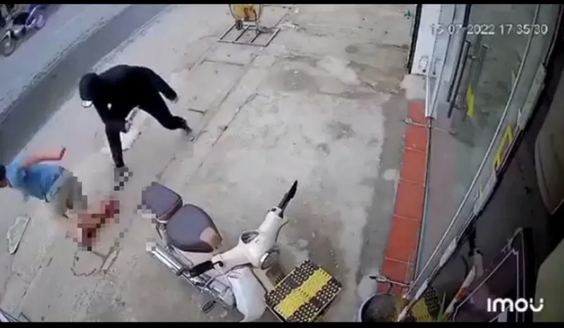 Điều tra vụ một thanh niên bị chém đứt lìa chân tại Hà Nội   -0