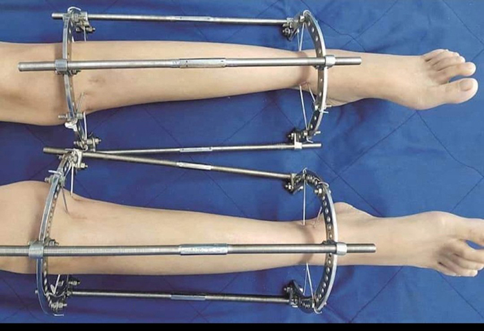 Bi kịch từ khát vọng… chân dài -0
