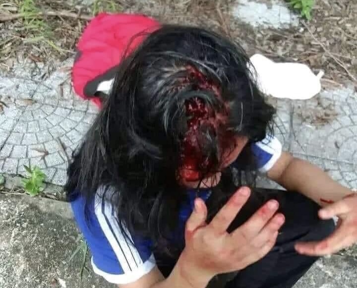 Không mua nước uống dùm bạn, 1 nữ sinh lớp 8 bị đánh toác đầu -0