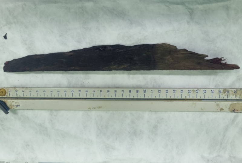 Cứu sống bệnh nhân bị thanh gỗ đâm xuyên phổi -0