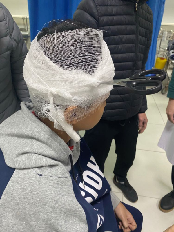 Cứu học sinh lớp 6 bị kéo đâm thủng hộp sọ -0