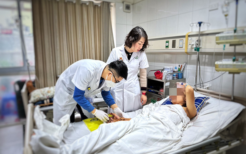 Lại thêm một thiếu niên 16 tuổi dập nát tay phải vì tự chế pháo nổ -0