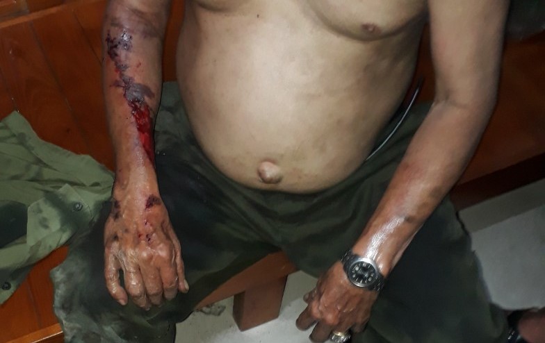 Gải cứu người đàn ông bị kẹt tay trong thang máy vì đi...tìm ví -0