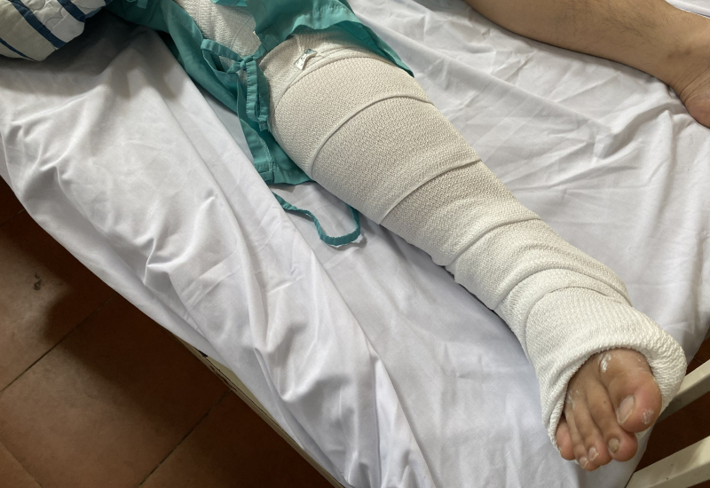 Cục CSGT thăm hỏi Đại úy Công an bị đối tượng say xỉn tông gãy chân -0