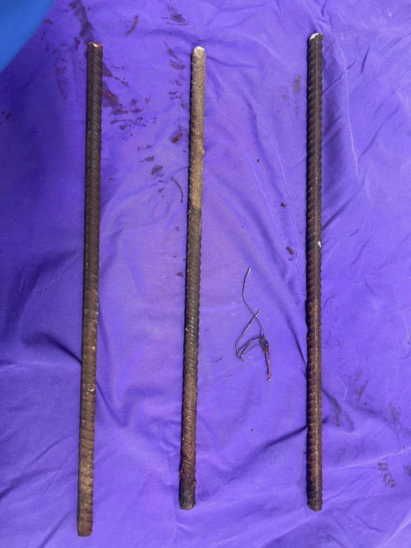 Cứu sống nam công nhân bị 3 cọc sắt đâm xuyên qua người -0