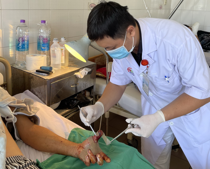 Nối thành công ba ngón tay trong một bàn tay bị đứt lìa -0