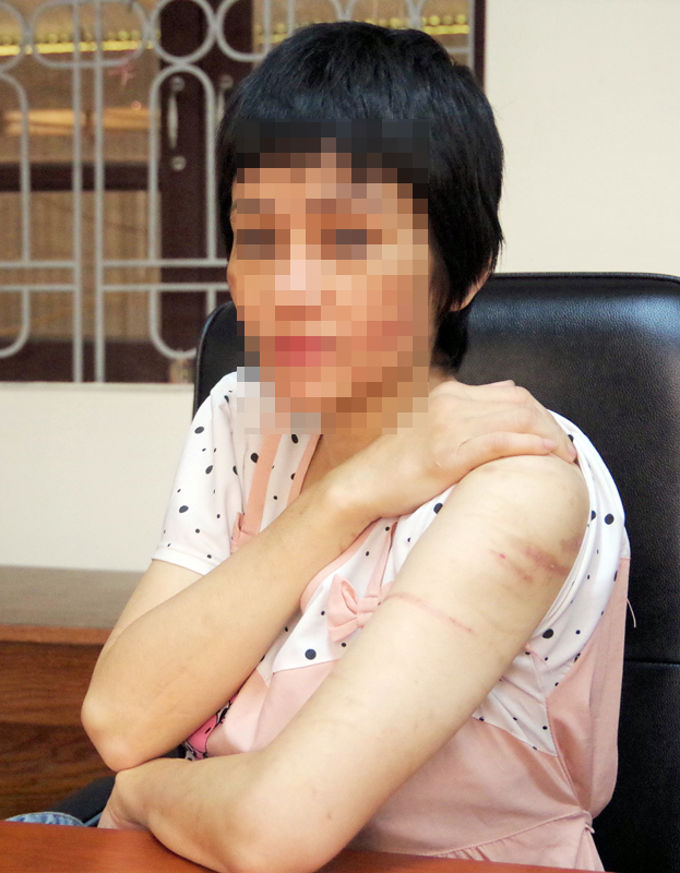 Khởi tố đối tượng bạo hành vợ đang mang thai 7 tháng -0