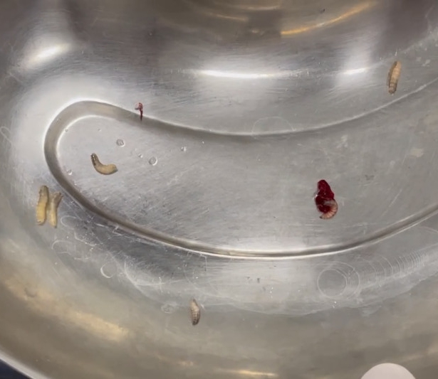 Hàng chục con giòi làm tổ trong tai -0