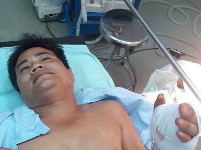 Hiểm họa khôn lường từ “súng bút” tự chế -0