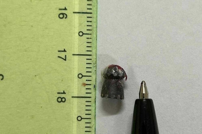 Mang súng đi săn bị cướp cò găm vào ngực lại khai báo do bị “đạn lạc” -0