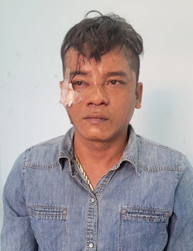 Tên cướp bị chặn bắt ngã xe nhảy kênh lẩn trốn nhưng không thoát -0