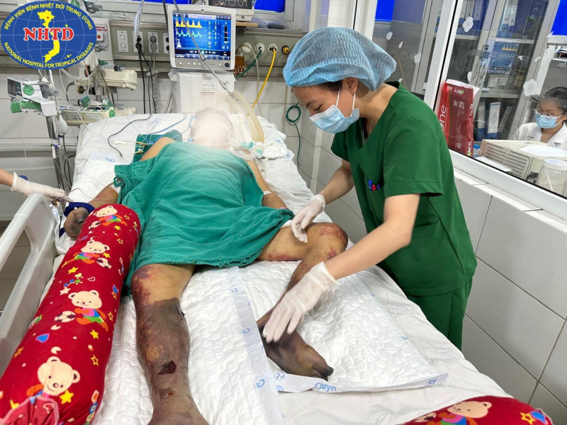 Nhiễm liên cầu lợn, người đàn ông phải cắt bỏ 2 bàn chân, ngón tay -0