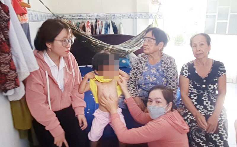 Bé gái 4 tuổi tại Cà Mau nghi bị cha nuôi đánh đập -0