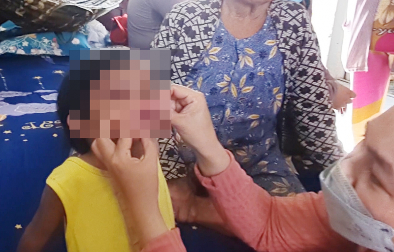 Bé gái 4 tuổi tại Cà Mau nghi bị cha nuôi đánh đập -1