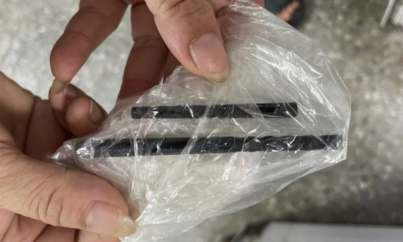 Phẫu thuật lấy đôi đũa đâm xuyên từ mũi vào não bệnh nhân -0