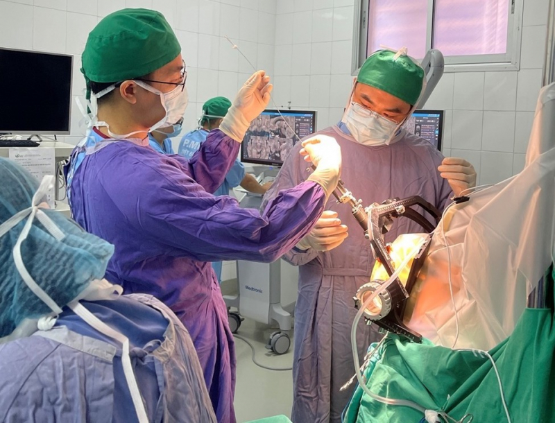 Bệnh nhân tỉnh táo hoàn toàn trong ca phẫu thuật kích thích não sâu -0