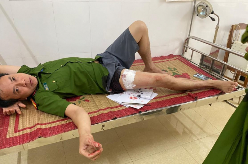 Dùng dao phóng lợn tự chế đâm trọng thương cán bộ Công an xã -0