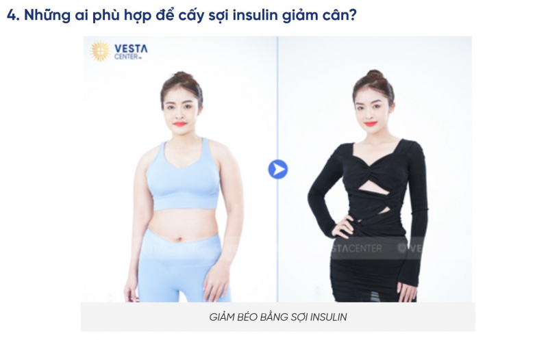 Dịch vụ cấy vi sợi sinh học Insulin để giảm béo là không có căn cứ khoa học -0