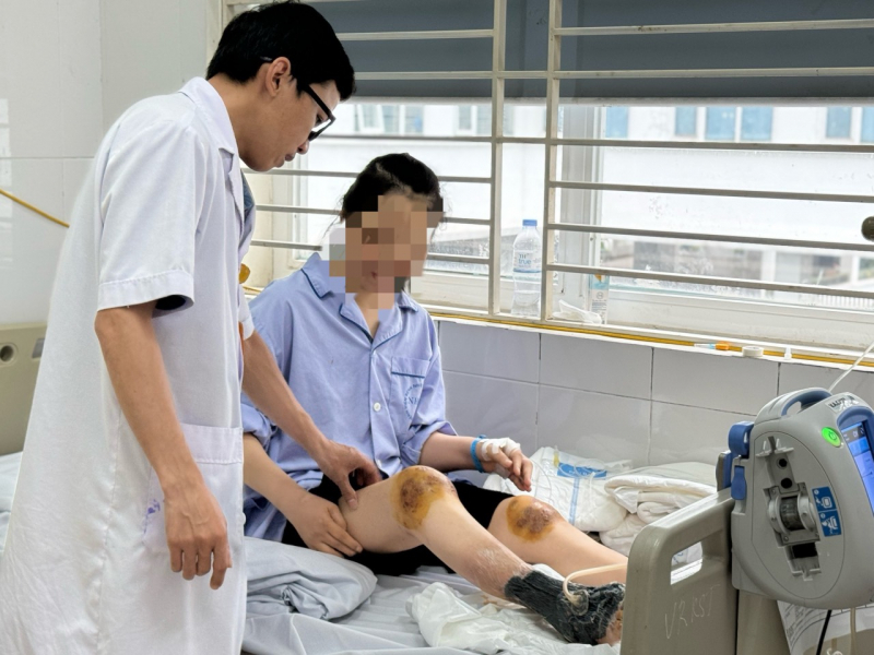 Dùng ong đốt vào đầu gối chữa bệnh, người phụ nữ bị hoại tử cẳng chân -0