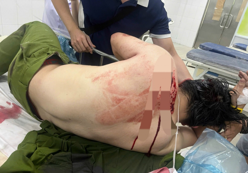 Bắt giữ đối tượng vào nhà thờ gây rối và dùng dao đâm 2 cán bộ Công an -0