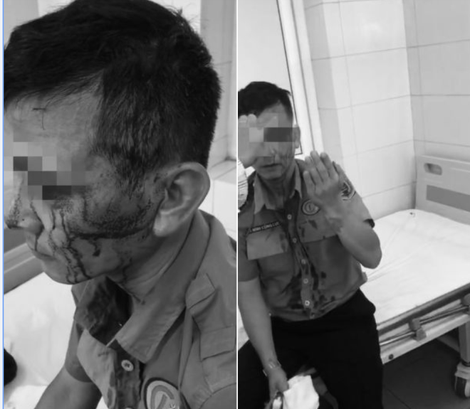 Nhân viên bảo vệ bệnh viện K bị hành hung phải khâu 8 mũi -0