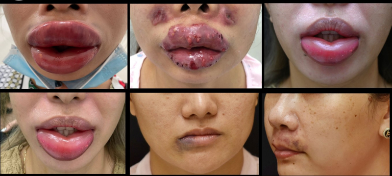 Các cơ sở “lấn sân” là thách thức lớn trong việc đảm bảo an toàn thẩm mỹ… -1