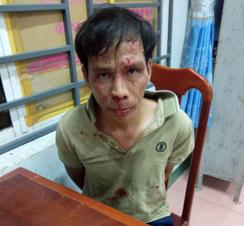 Bất ngờ bị chém trọng thương, Thiếu tá Công an vẫn khống chế được đối tượng  -0