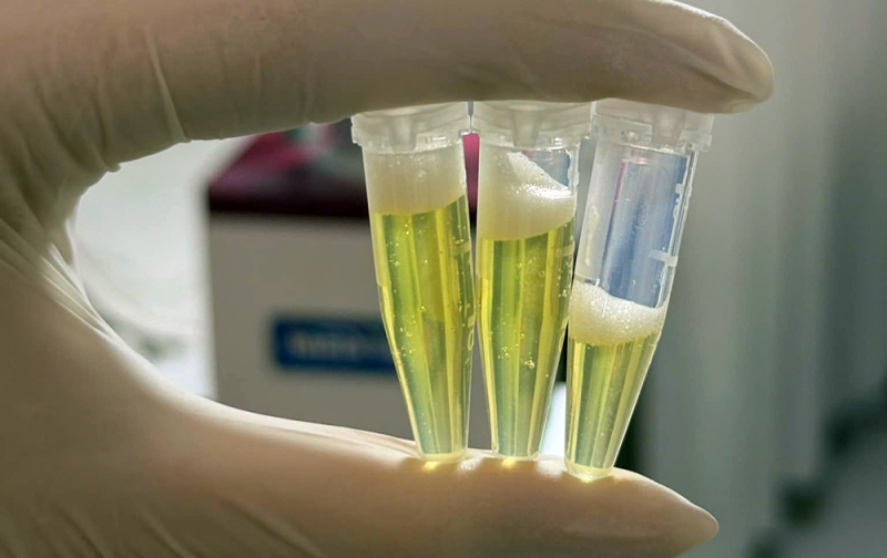 Tự hút máu mình để làm đẹp -0