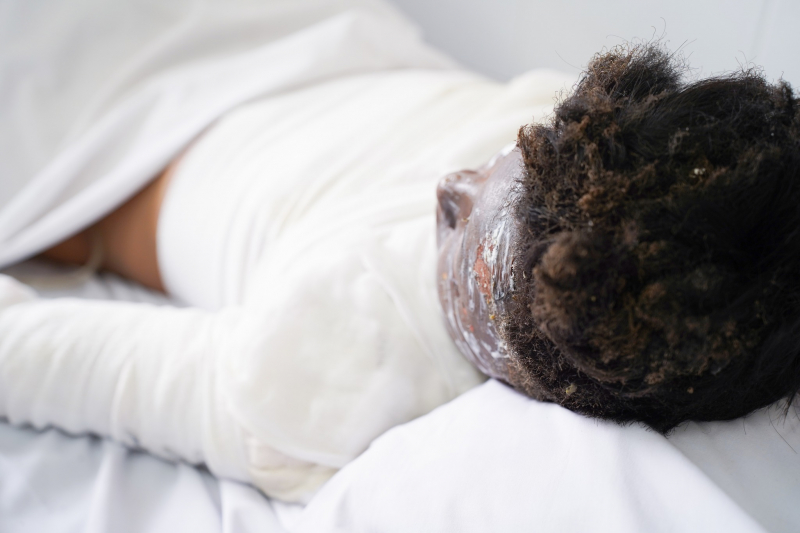 Thêm nhiều trường hợp học sinh bị tai nạn nghiêm trọng do tự chế pháo nổ  -2