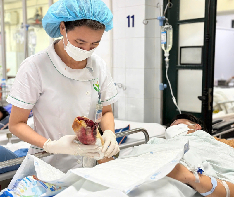 Ba ngày nghỉ Tết, có 63 trường hợp khám, cấp cứu do pháo nổ -0