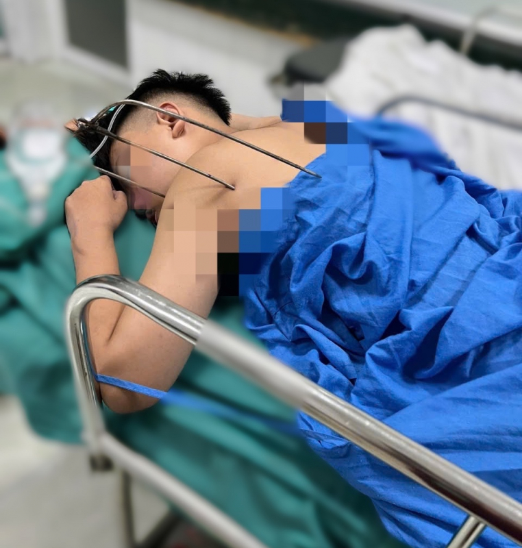 Cứu sống thiếu niên bị đinh ba tự chế đâm vào tim  -0