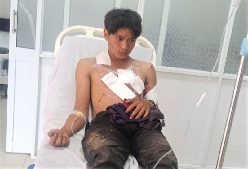 Nổ mìn tự chế khi đi đánh cá, 2 người bị thương nặng -0
