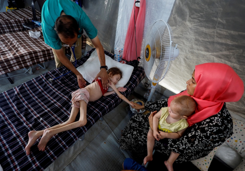 Khủng hoảng nhân đạo ở Gaza: Nhiều trẻ em thiệt mạng vì suy dinh dưỡng giữa cuộc bao vây của Israel -0