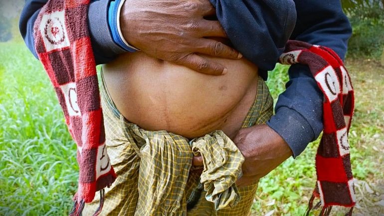 Bi kịch ở những “ngôi làng một thận” tại Bangladesh -0