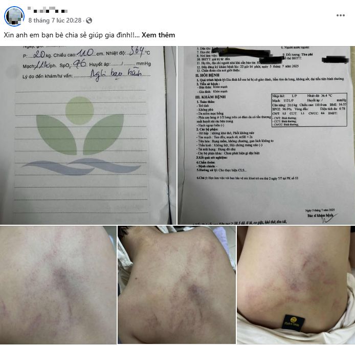 Tạm đình chỉ 2 cô giáo nghi bạo hành trẻ mầm non ở Bồ để điều tra -0