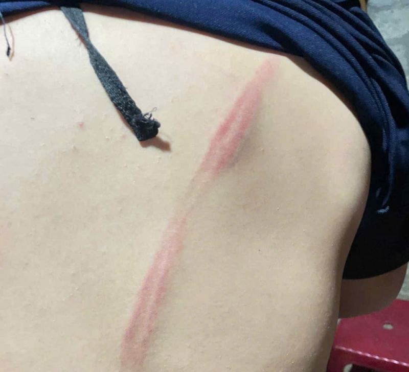 Điều tra vụ việc nam sinh lớp 8 bị hàng xóm xích chân, đánh đập -0