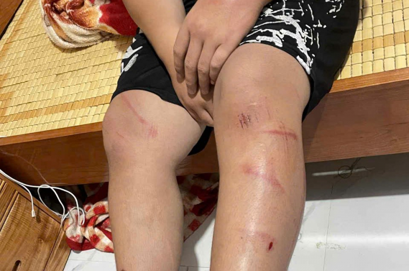 Điều tra vụ việc nam sinh lớp 8 bị hàng xóm xích chân, đánh đập -0