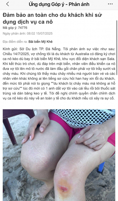 Đà Nẵng: Chấn chính dịch vụ ca nô kéo dù sau sự cố du khách nước ngoài bị thương -0