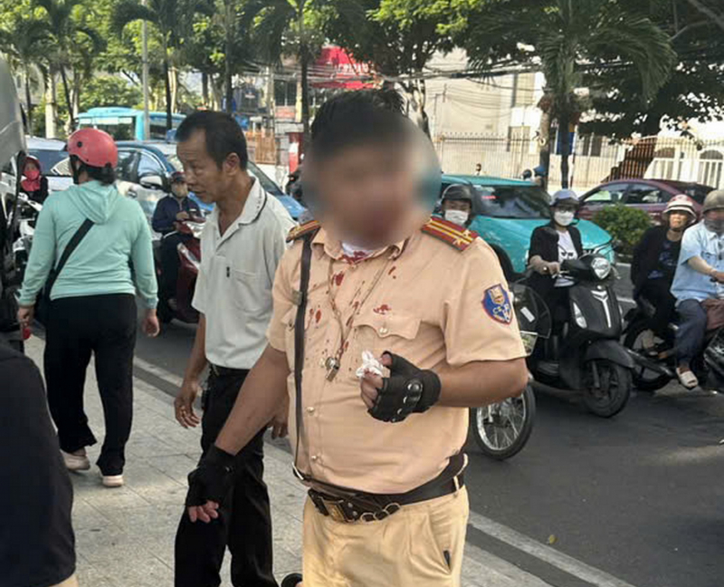 Tạm giữ hình sự một người Nga đấm cán bộ CSGT đang thi hành công vụ. -0