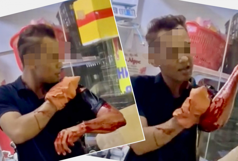 Truy xét đối tượng cầm hung khí chém nhân viên giữ xe quán dê thui trọng thương -0