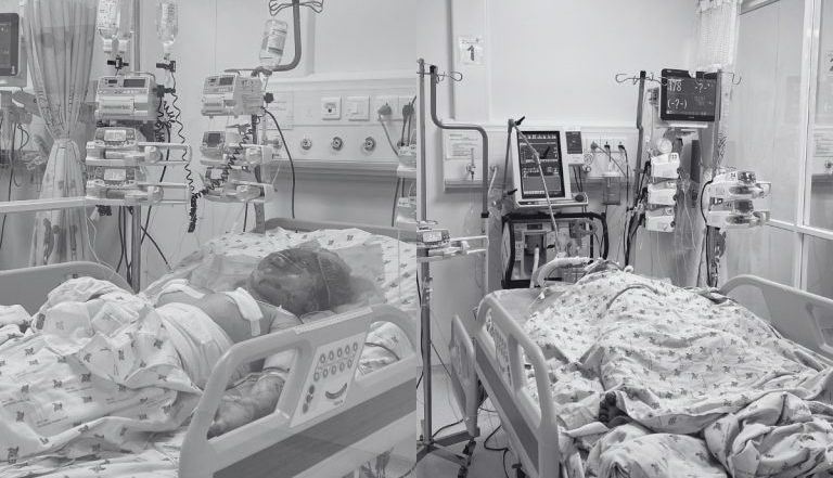 สองพี่น้องถูกส่งโรงพยาบาลในอาการวิกฤต หลังถูกพ่อแท้ๆ วางเพลิง -0