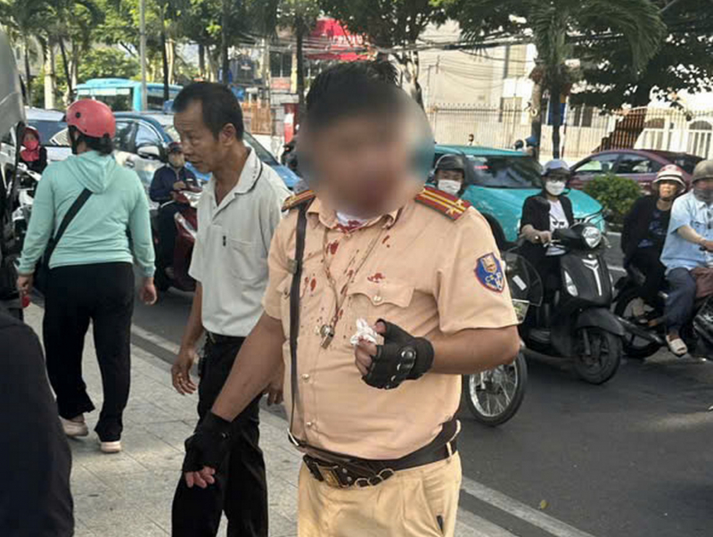        Khởi tố người Nga đã đấm cán bộ CSGT đang thi hành công vụ. -0