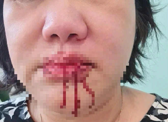 Xã hội hiện đại và bóng đen bạo lực công cộng -0