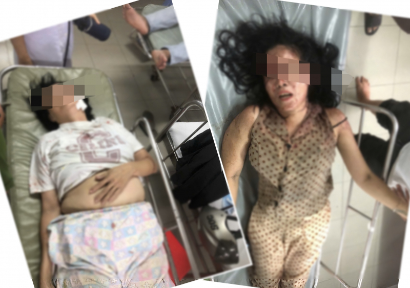 Mâu thuẫn gia đình, sát hại mẹ vợ và vợ hờ rồi tự sát -0